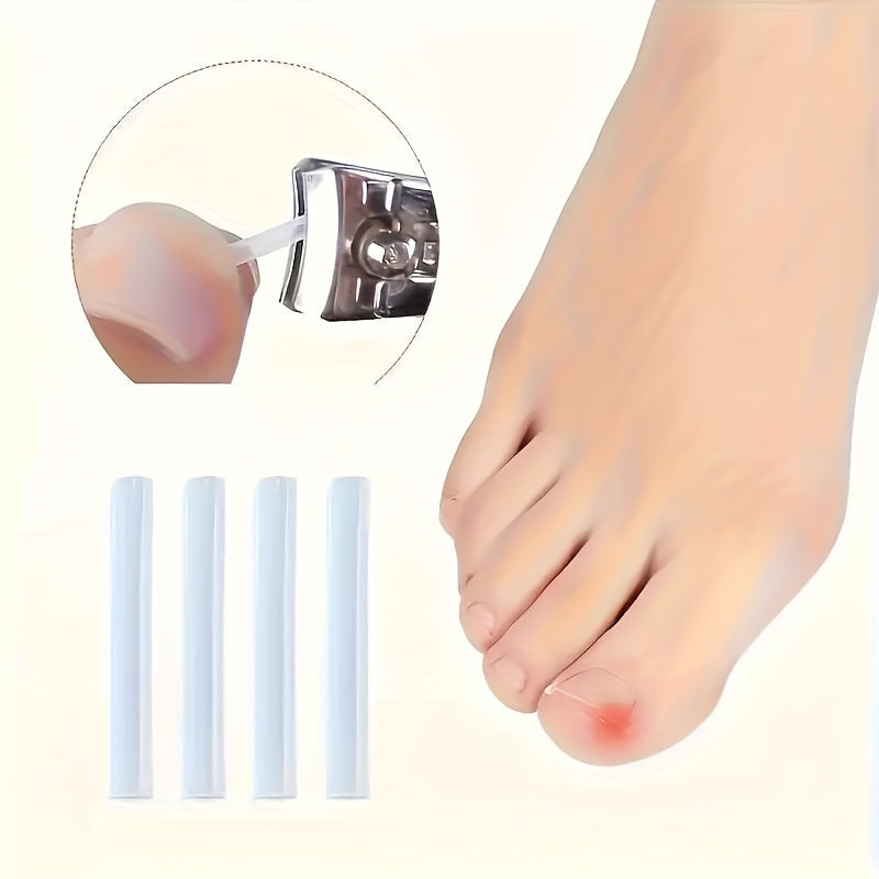 ingrown toenail   20 30   50   70 80 90 100pcs