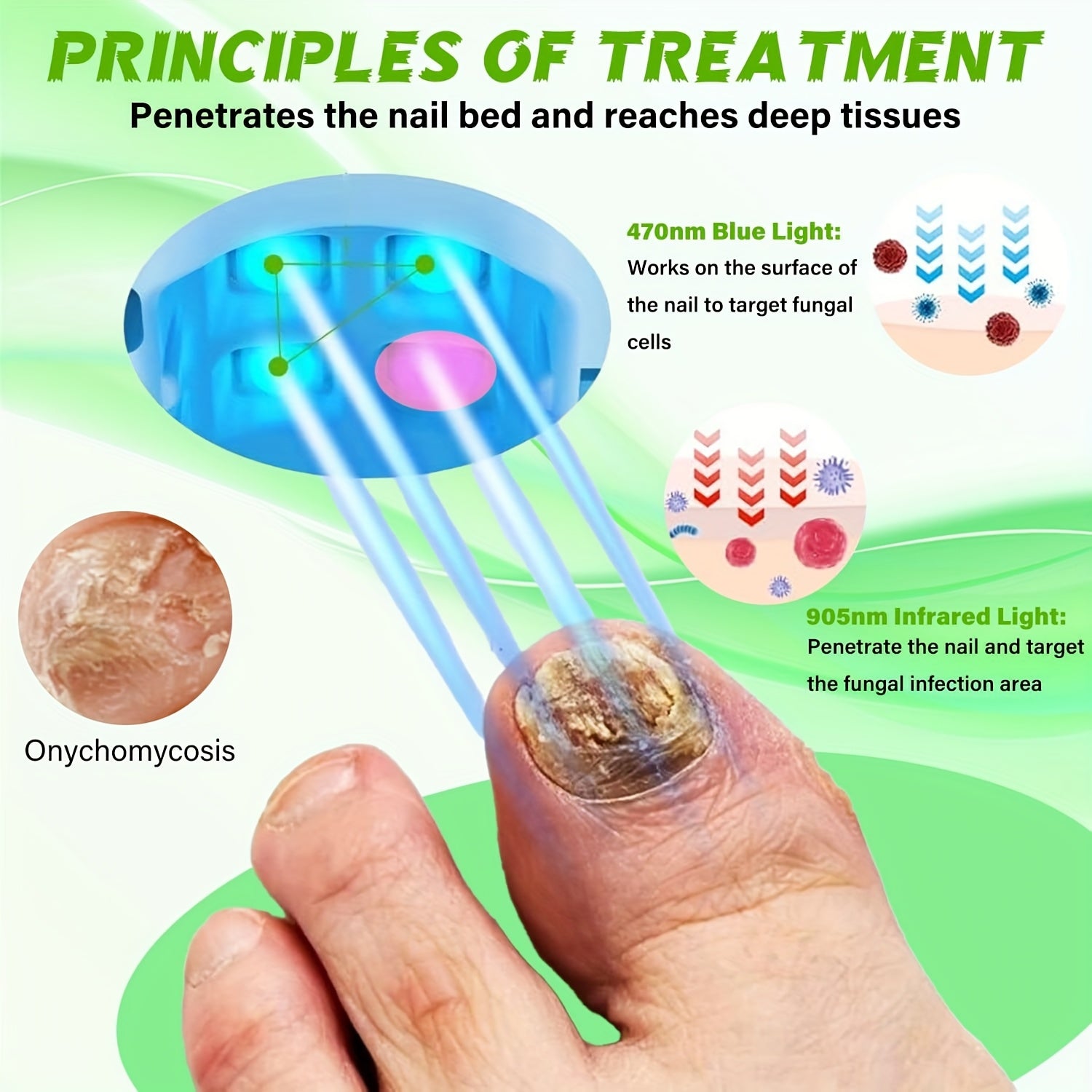 nail fungus laser device laser device fungal