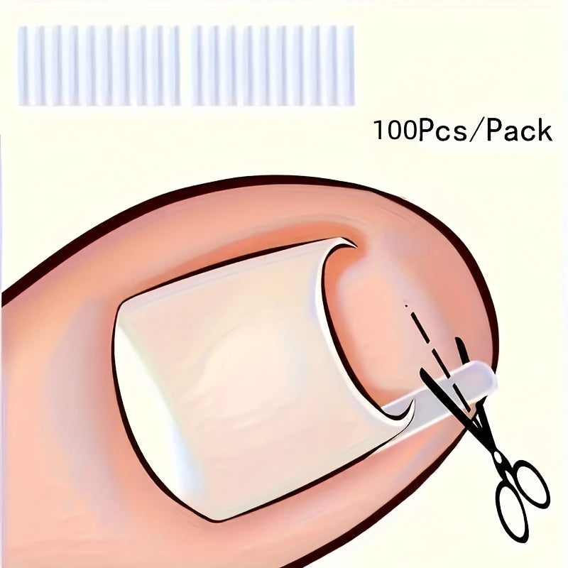 ingrown toenail   20 30   50   70 80 90 100pcs